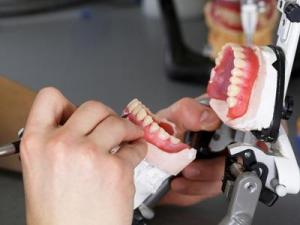 Protetik Diş Tedavileri (Protez Diş Uygulamaları)